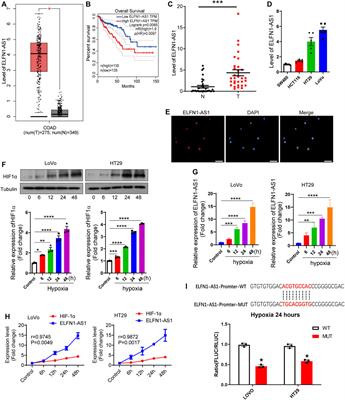 Hypoxia-Induced Upregulation of lncRNA ELFN1-AS1 Promotes Colon Cancer Growth and Metastasis Through Targeting TRIM14 via Sponging miR-191-5p